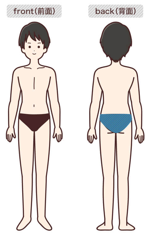 お尻の脱毛部位