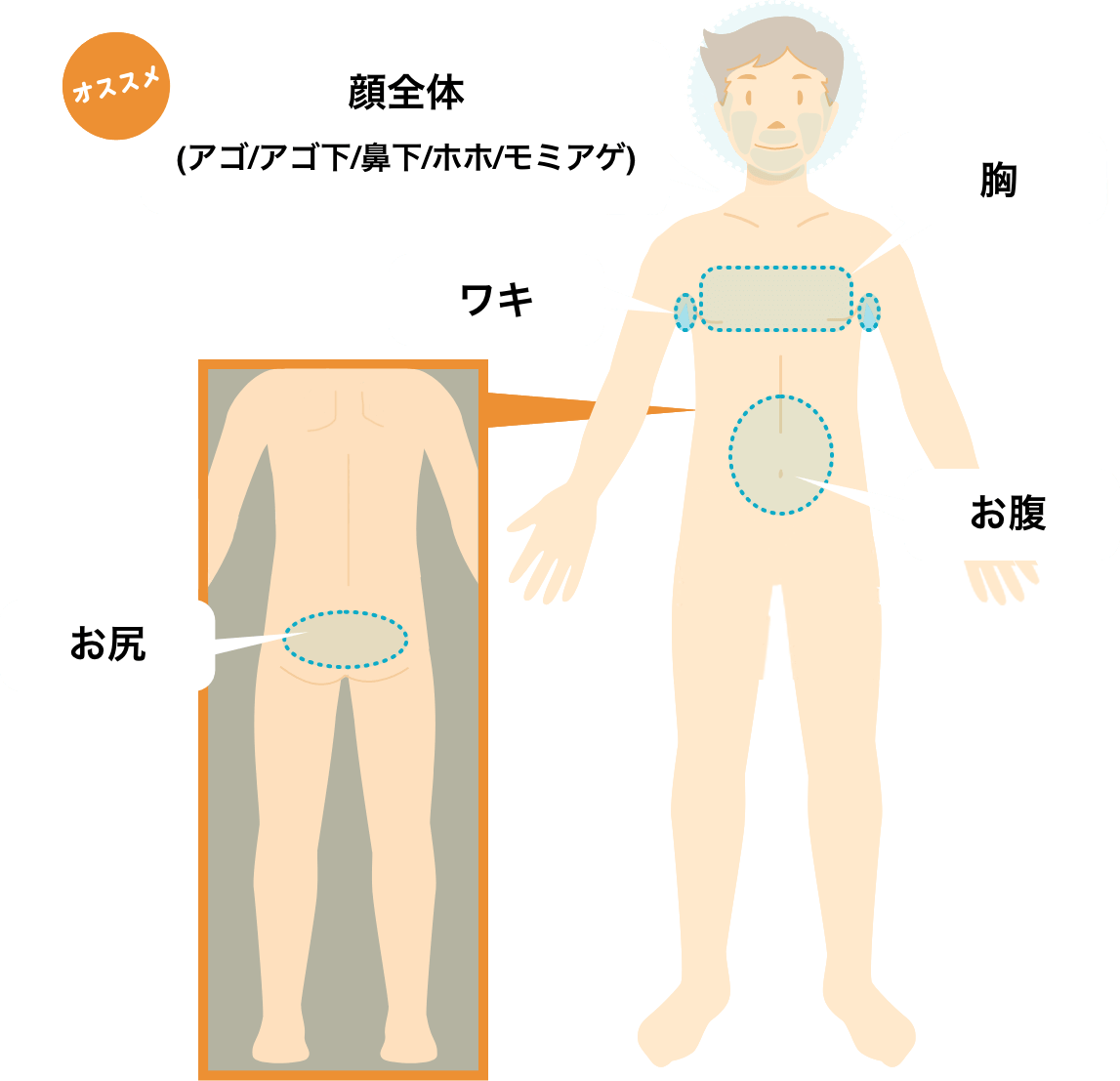 顔全体（アゴ・アゴ下・鼻下・ホホ・モミアゲ）、胸、お腹、ワキ、お尻からお好きな１箇所！