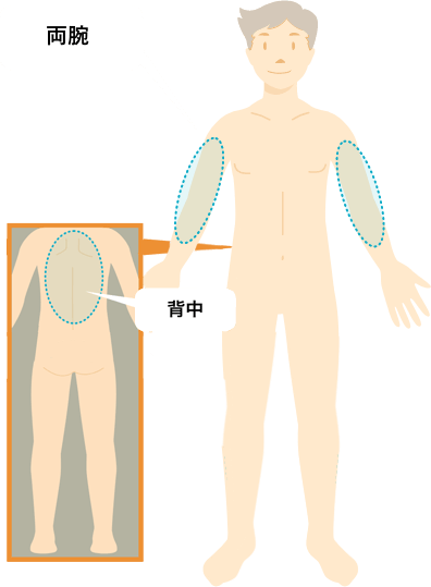 両方の腕(肘周り、手、指まで対象)、背中からお好きな１箇所！