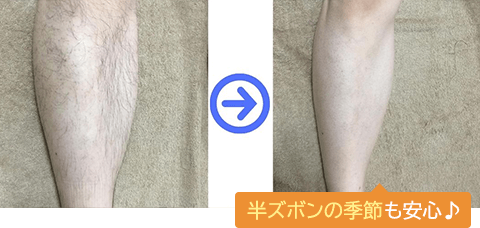 アゴ下の所々が抜けて、髭剃りの時間が極端に短縮！