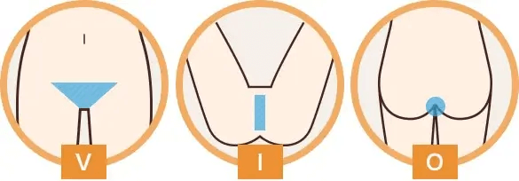 VIO施術範囲