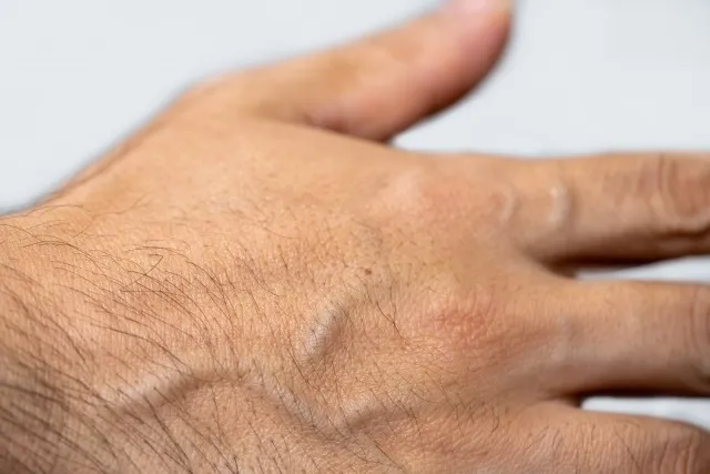 脱毛と手のケアで神奈川県大和市で理想の美肌を目指す方法
