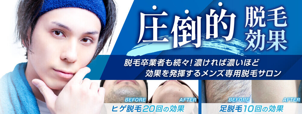 圧倒的脱毛効果　脱毛卒業者も続々！濃ければ濃いほど効果を発揮するメンズ専門脱毛サロン