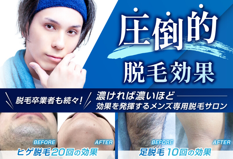 圧倒的脱毛効果　脱毛卒業者も続々！濃ければ濃いほど効果を発揮するメンズ専門脱毛サロン