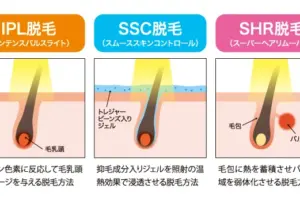【大和脱毛の知って得する情報】光脱毛の種類を理解しよう！